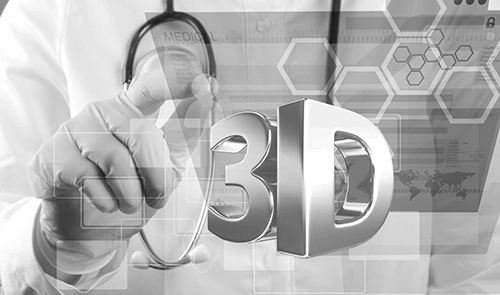 RF(tun)3Dӡ㲿_(d)f(wn) ®a(chn)ƷڌRi8܇